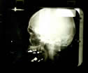 Image - radiographie