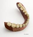 Image - DENTURES